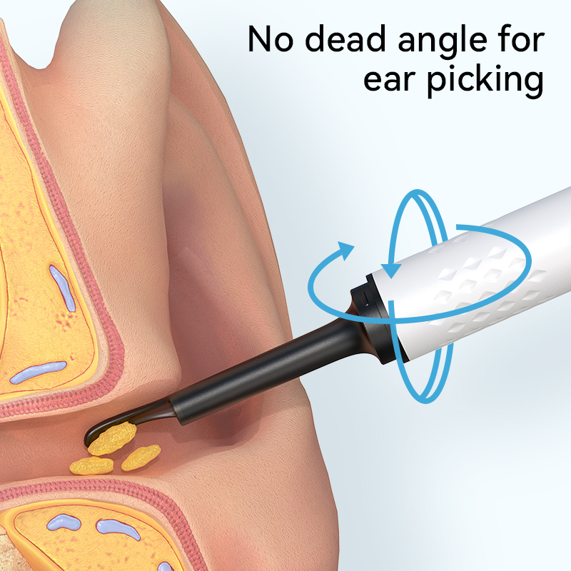 Pembersih telinga untuk kamera - Health Power Tools ulasan dan harga